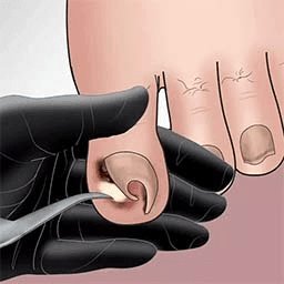 帮小姐姐去脚皮官方版 v2023.11.21 安卓版