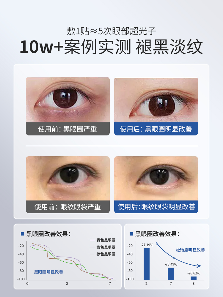 眼部细纹用什么医美方式去掉好？求专业解答