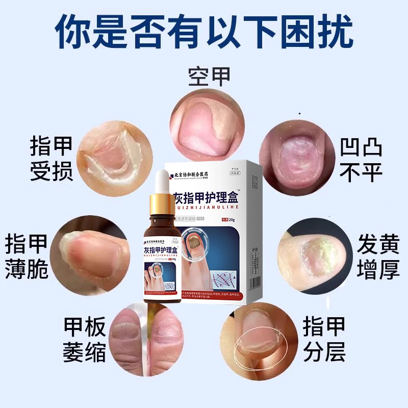 宝骏云朵停产了，售后问题怎么解决？