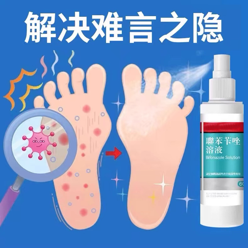 联本苄唑喷雾溶液：告别脚气困扰，重拾清爽自信！✨