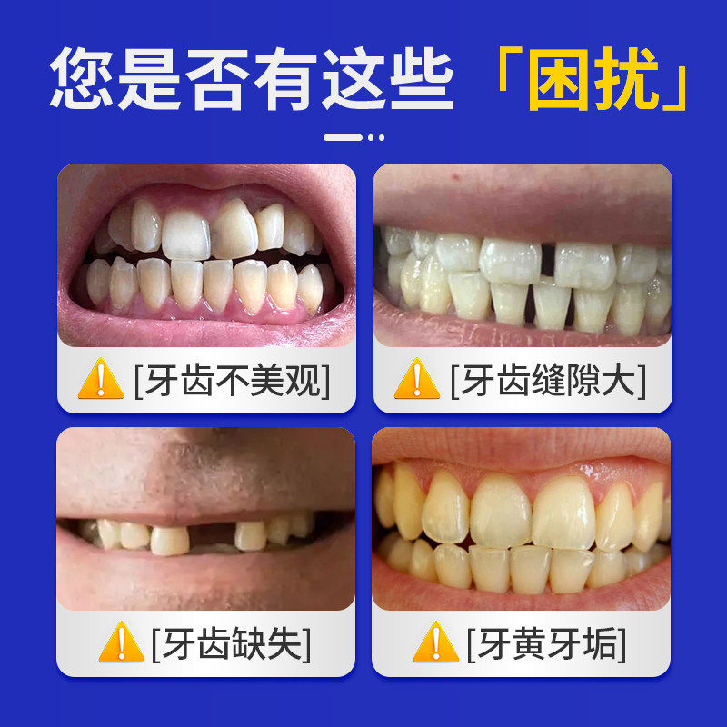 成人用牙套如何选择才能既实用又美观？