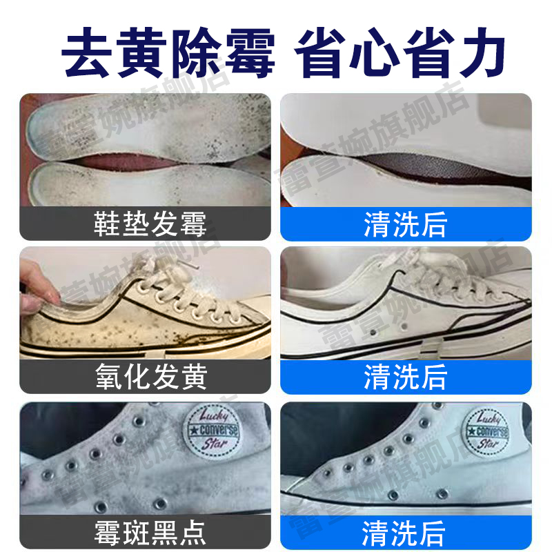 匡威鞋边变黄了怎么变白？拯救你的老匡威！