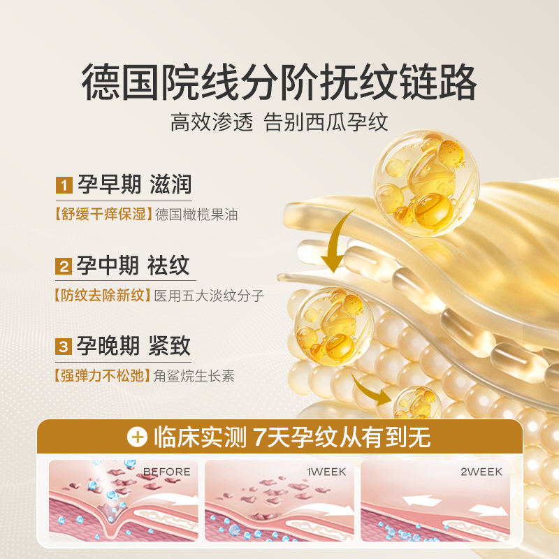 孕期必备神器！Nepicy妊娠油，专治肚纹，告别肥胖纹，迎接完美肌肤！