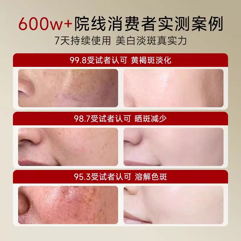 为什么晒斑总是挥之不去？有哪些晒斑去除小妙招？