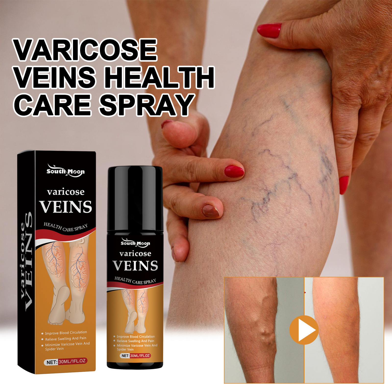 Varicose Veins Cream: 腿部静脉曲张救星，告别粗壮腿纹