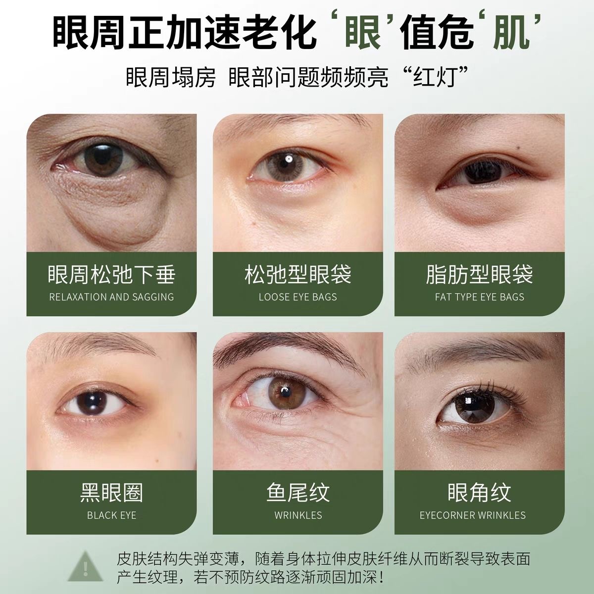为什么鱼尾纹会很明显?如何有效改善?