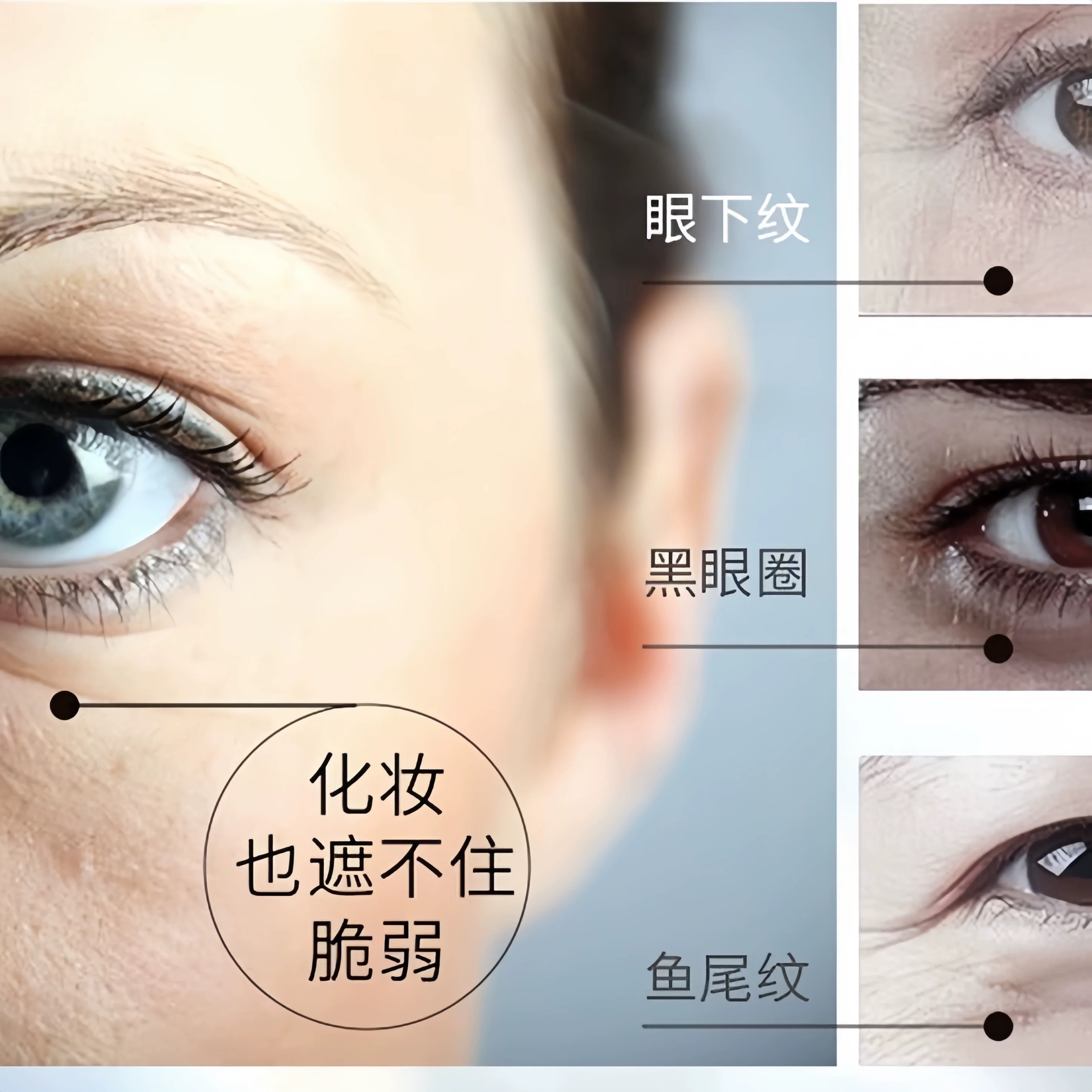 为什么眼袋会变得这么大？背后的原因是什么？