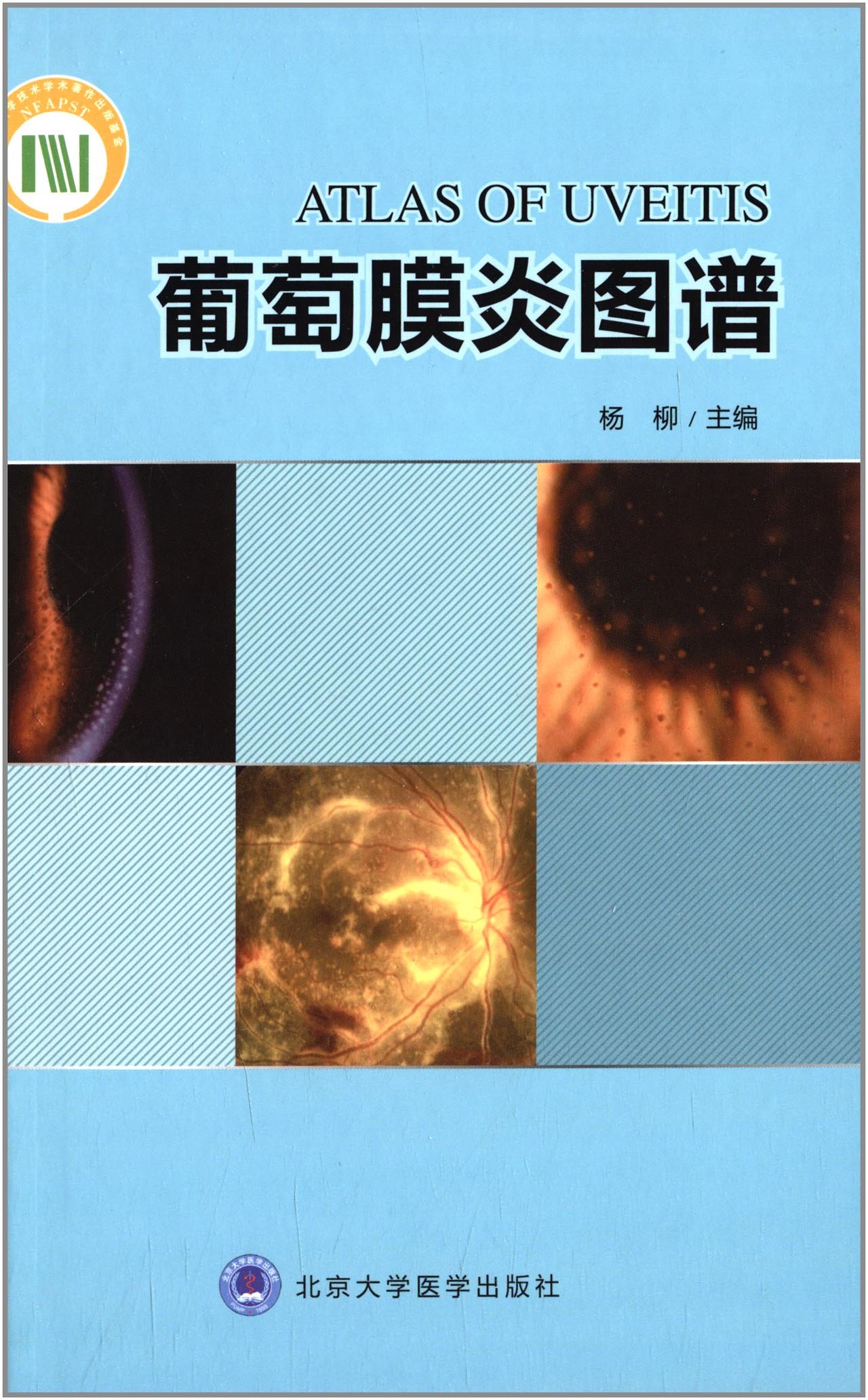 【独家揭秘】葡萄膜炎图谱：杨柳教授力作，直击眼科疑难杂症，北京大学医学出版社倾情呈现！