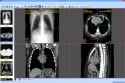 Sante CT Viewer1.2