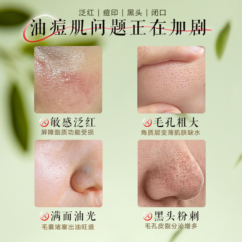 怎么祛痘印最快最有效?专业护肤博主来支招!