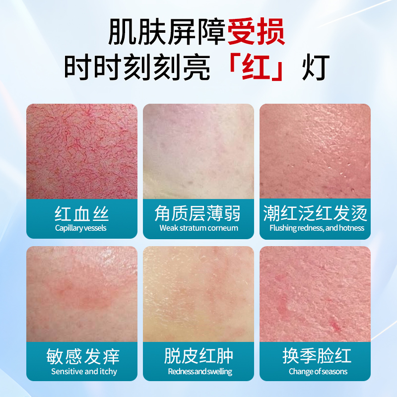 为什么保湿水适合各种皮肤使用？