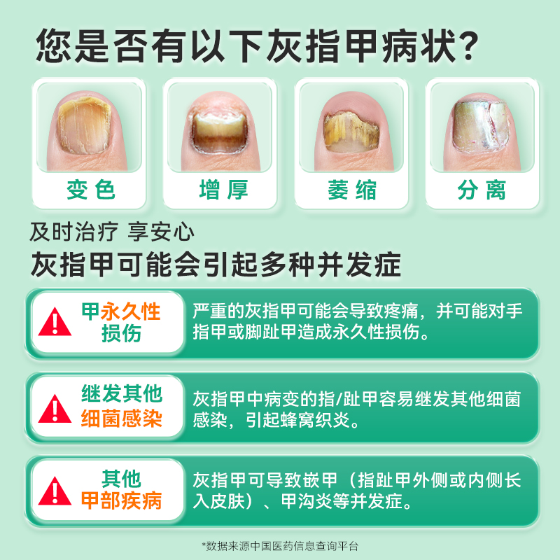 灰指甲专用药：告别脚气困扰，正品旗舰店护航，专业治疗甲癣