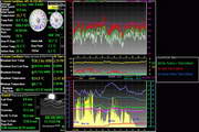 Weather Display10.37R Build 317