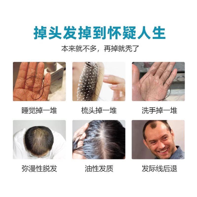 生发帽激光头防脱育护发红光密发增发仪长头发红外线头皮护理仪器：脱发终结者，让你重获浓密秀发的秘密武器！
