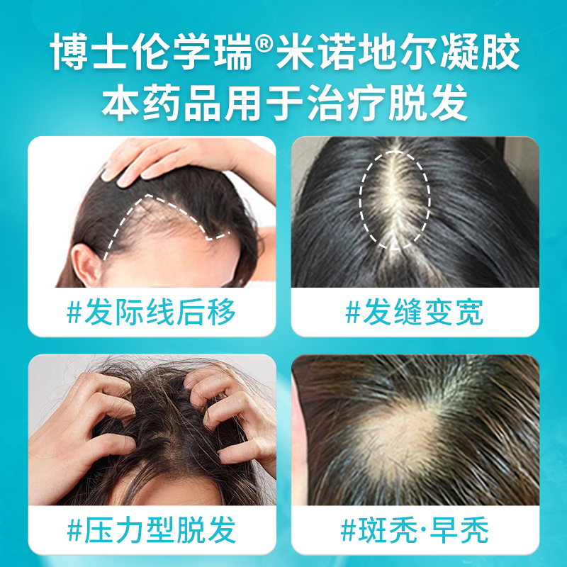 博士伦学瑞米诺地尔凝胶：告别脱发，重塑自信秀发的秘密武器！