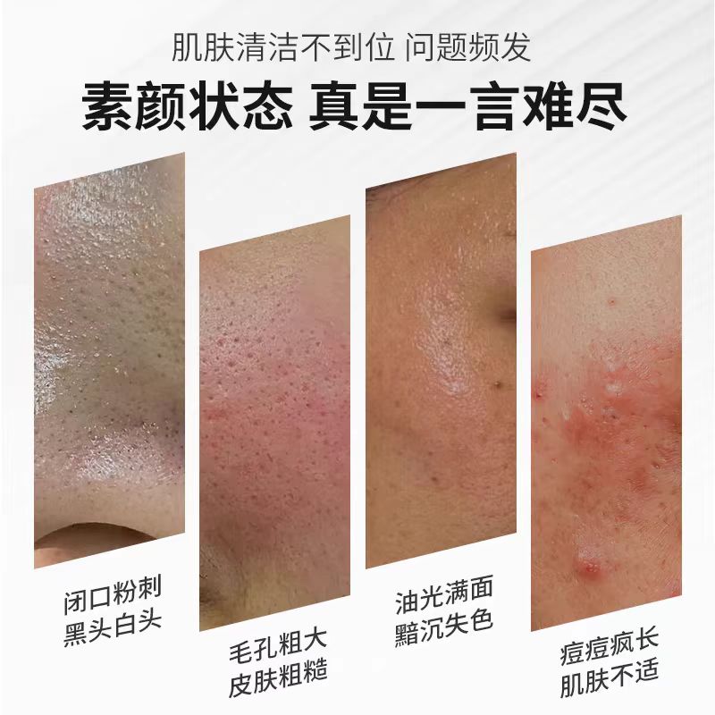 为什么脸部毛孔粗大？如何改善有小妙招吗？