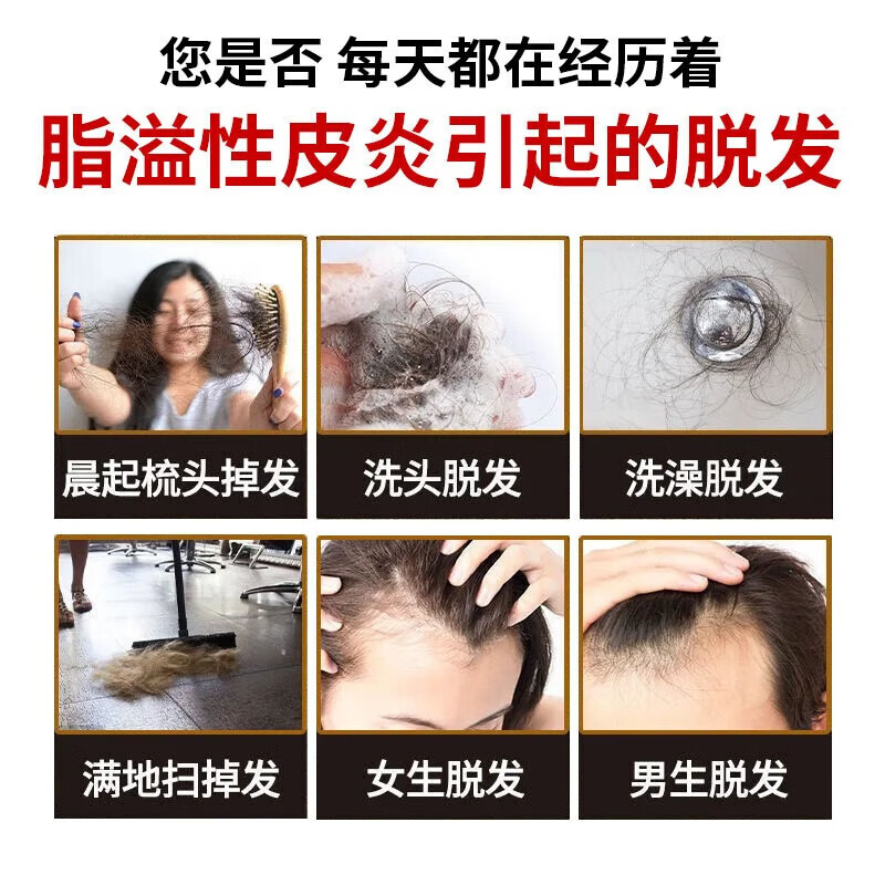 学生脱发怎么办？拯救发际线的科学方法