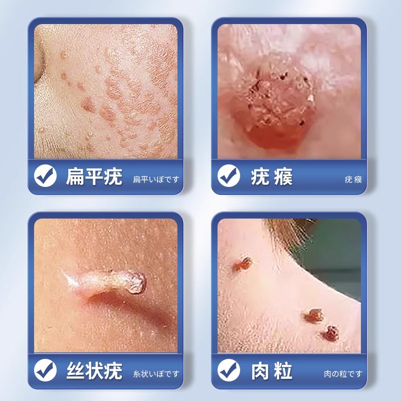美因特抑菌液：男性健康守护神，告别不适，拥抱自信