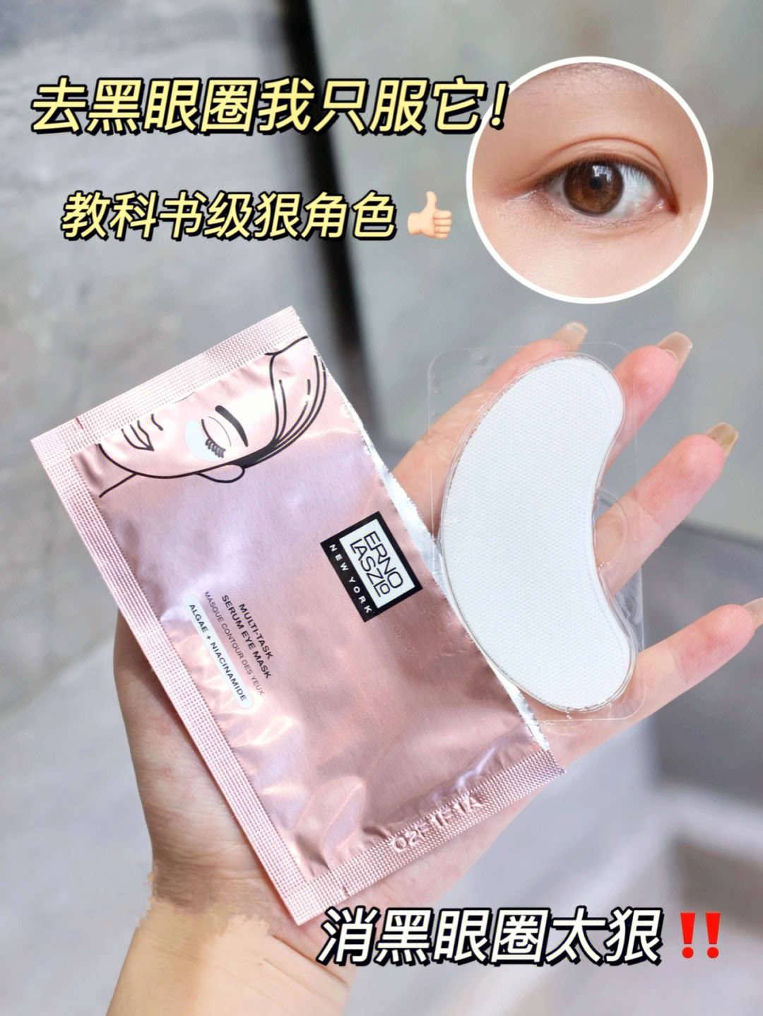 黑眼圈重怎么改善？拯救熊猫眼的终极攻略