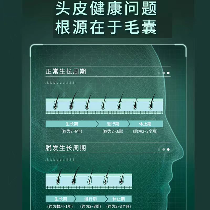 浮美赋活头皮精华液：解锁头皮健康的秘密武器，你还在等什么？