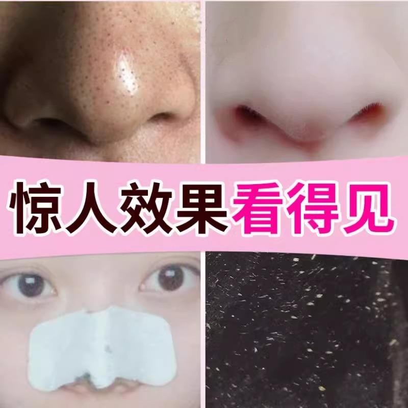 屈臣氏儿童去鼻子黑头粉刺鼻贴：草莓鼻神器，专为青少年学生设计！