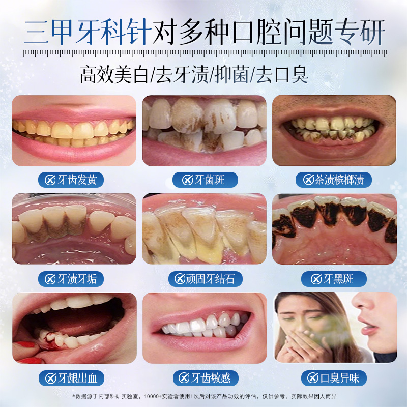 洗牙粉大揭秘：告别黄牙、烟渍，牙齿亮白的秘密武器