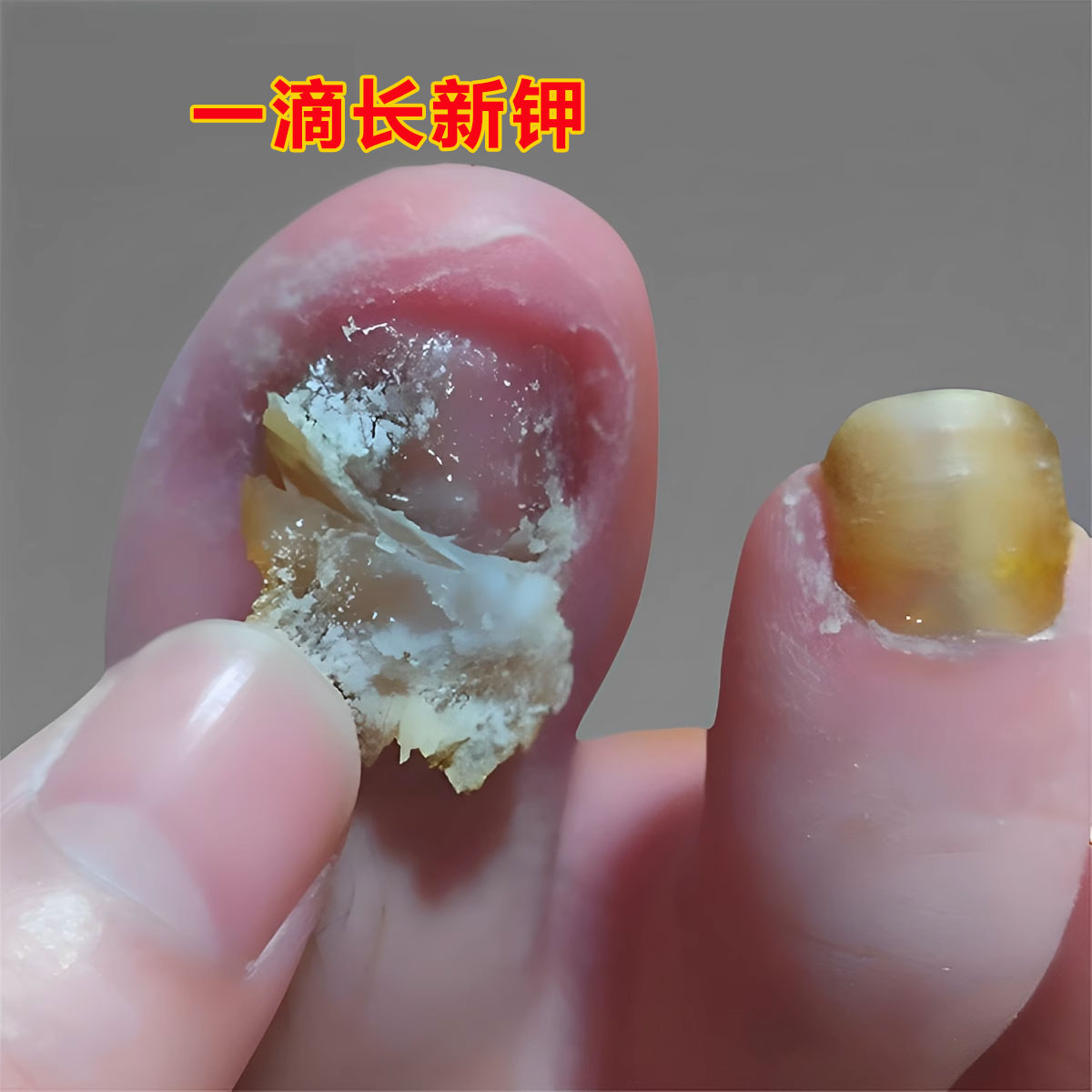 同仁堂热卖【不净包退】滴一滴，坏甲变好钾，长新甲，享受好甲生活？真相揭秘！