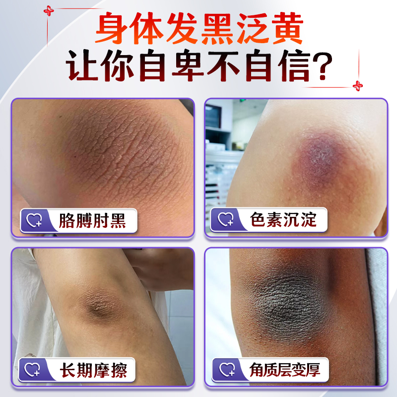 告别黑皮肤，天生黄也能用！脖子手臂腋下关节美白攻略，买1送1大促销！