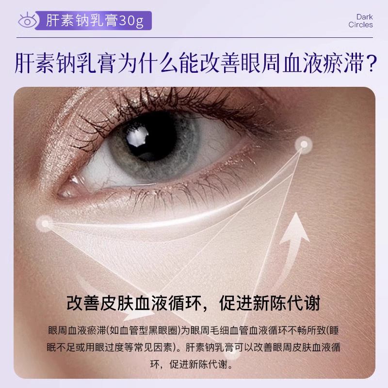 为什么会有黑眼圈？形成原因深度解析