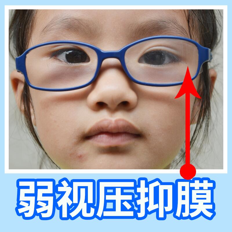 弱视儿童必备！遮光眼贴布真香预警！这波不冲真的亏了
