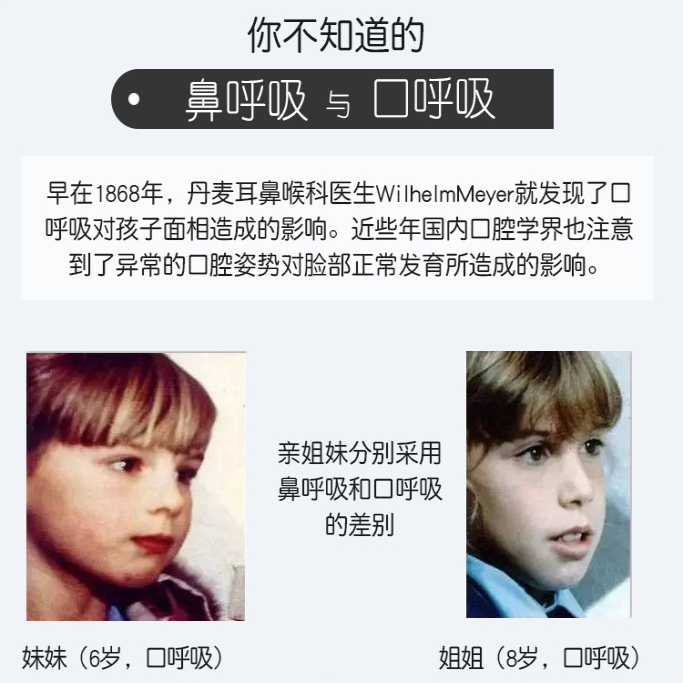 法兰克矫治器：牙齿矫正的秘密武器，笑容升级必备神器！