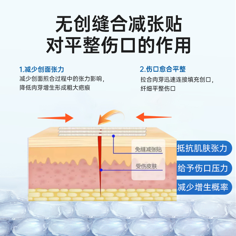 SWEETCHIC医用皮肤减张贴：告别疤痕烦恼，轻松恢复美丽！