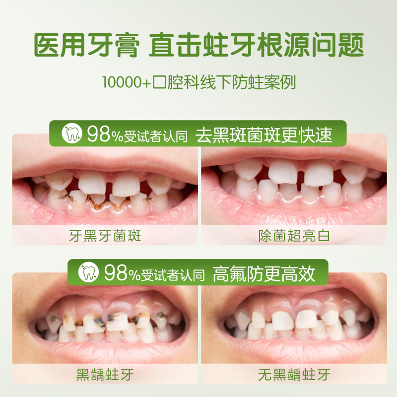 牙膏含氟和不含氟有什么区别？刷牙选对真的能防蛀牙！