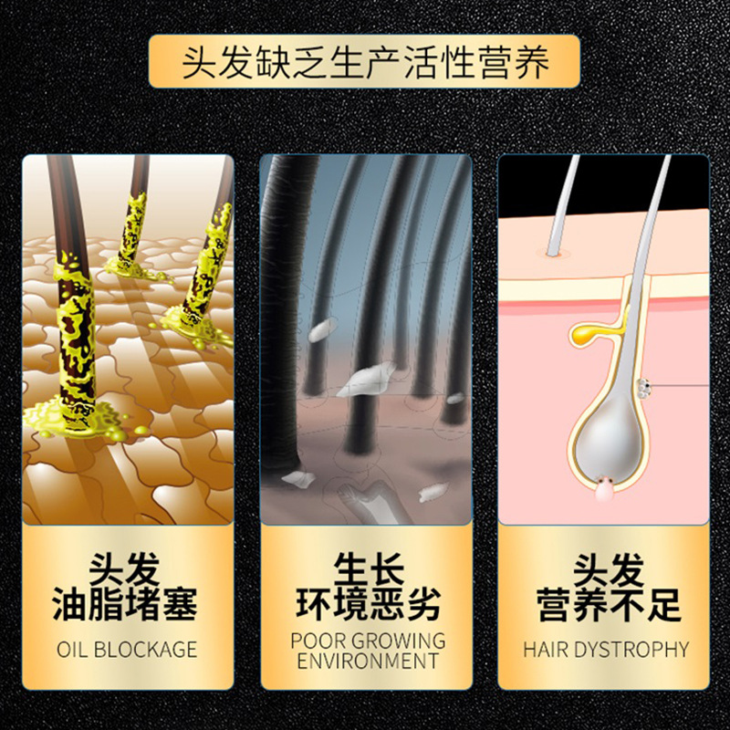 日本东京制药脱防发育洗发水：告别脱发烦恼，重获浓密秀发！