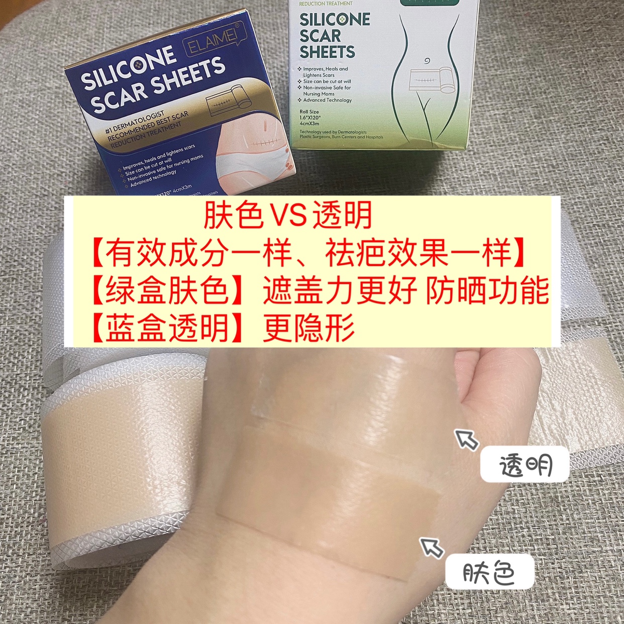剖腹产全程拍摄40分钟，亲历者告诉你真实感受，建议收藏！