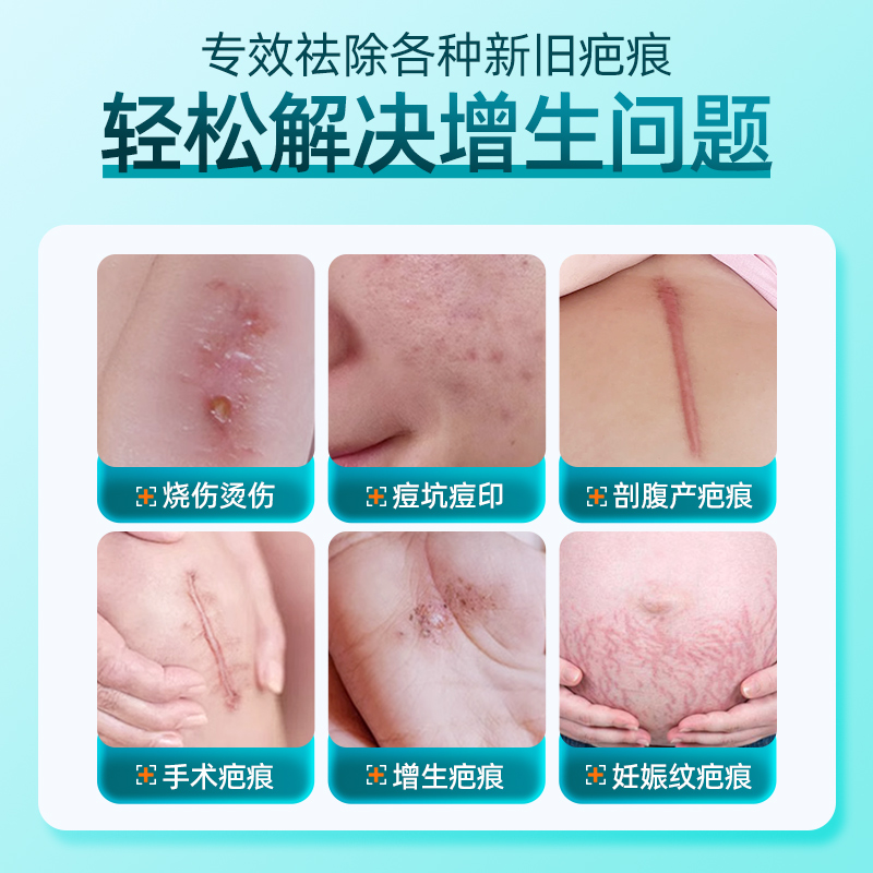 剖腹产疤痕增生怎么去除？教科书般的手法，让疤痕无处遁形，拯救你的美丽！