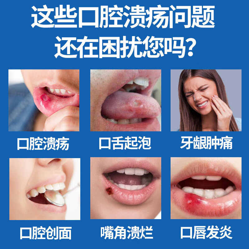 溶菌酶含片30片肠溶：口腔溃疡咽喉炎的特效专用根药？