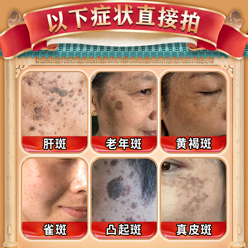如何有效防止老年斑的出现？专业护肤指南来了！