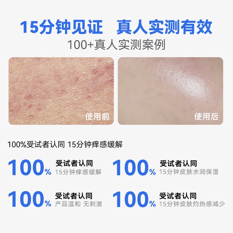 修宁悦特护乳：告别瘙痒，重拾肌肤屏障的守护神