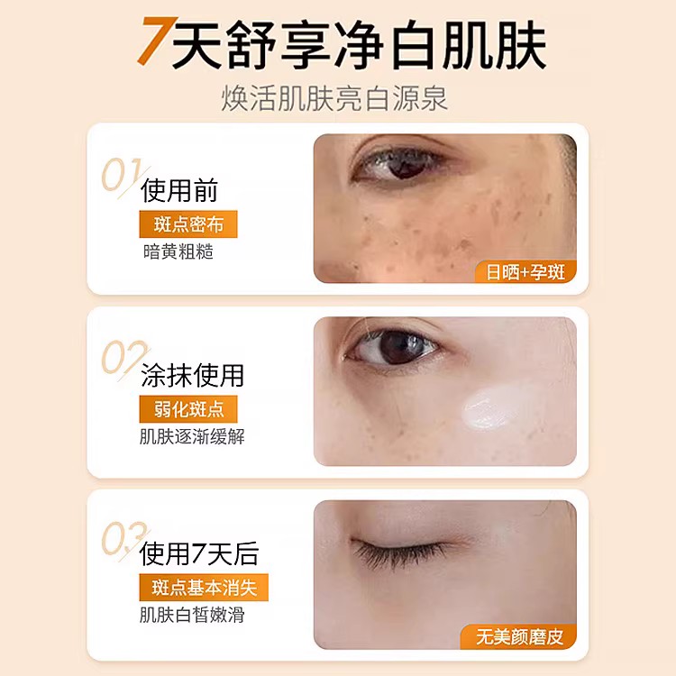 晒斑是什么样的形状？如何辨别和应对晒斑问题