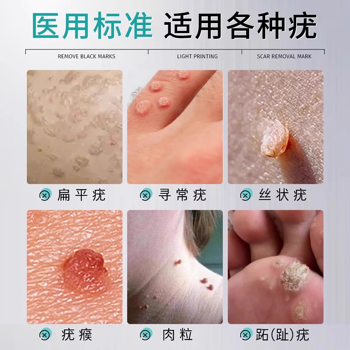 妙归苓mgl疣候清康肤膏：扁疣平祛神器，告别小肉粒！✨