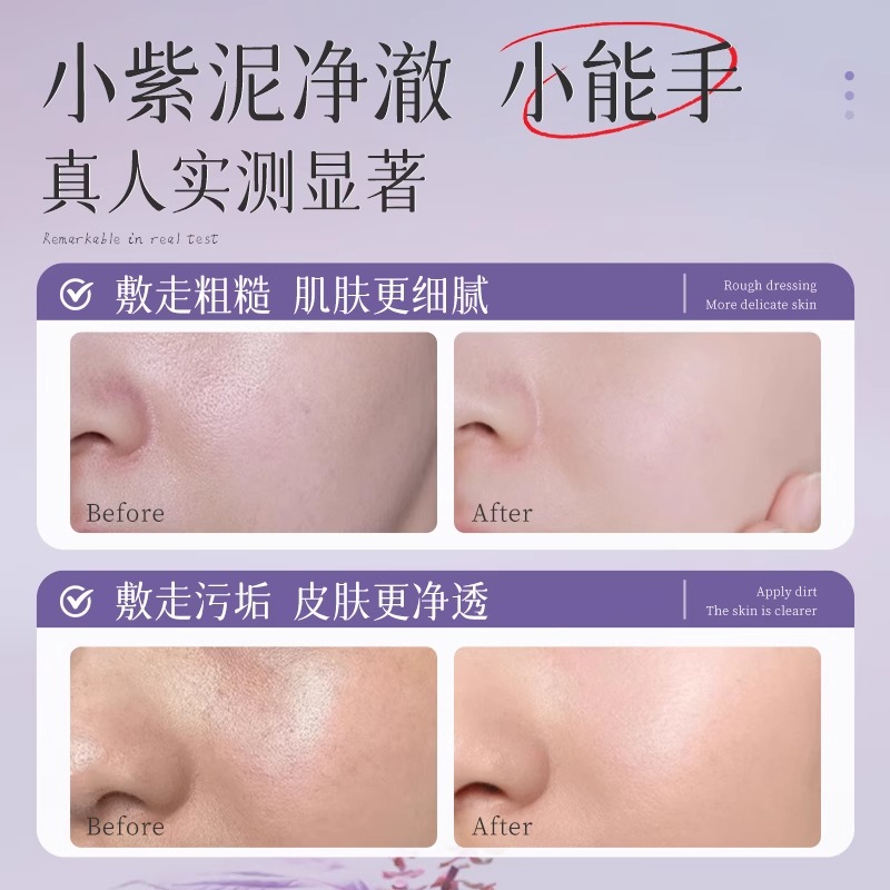 越敷越白！油豆肌救星！黑头粉刺一扫光！这泥膜真的绝了！！
