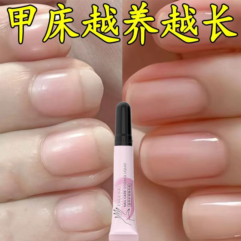 【胖东莱甄选】防倒刺裂甲起皮干裂美甲护理精华修复液指甲营养油，拯救干燥粗糙的手指艺术！