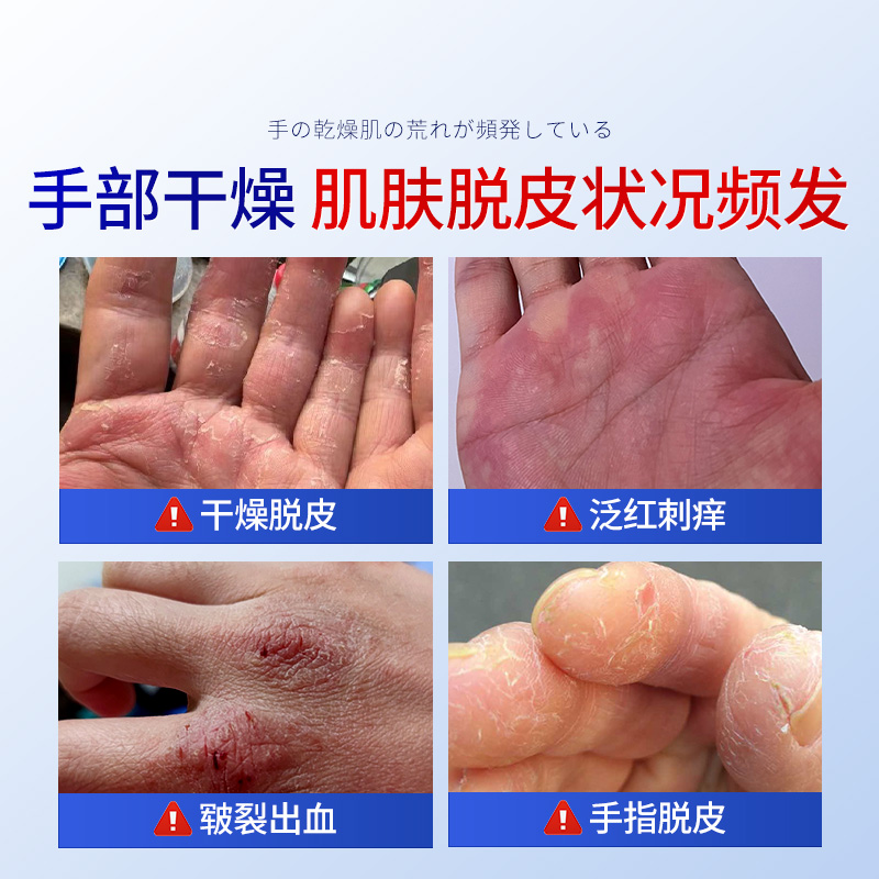亲润手霜：补水神器，正品保障，告别干燥，拥抱滋润！