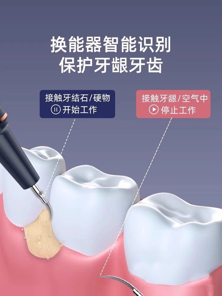 悦来客超声波洁牙器：告别牙渍牙结石，美牙神器来袭！