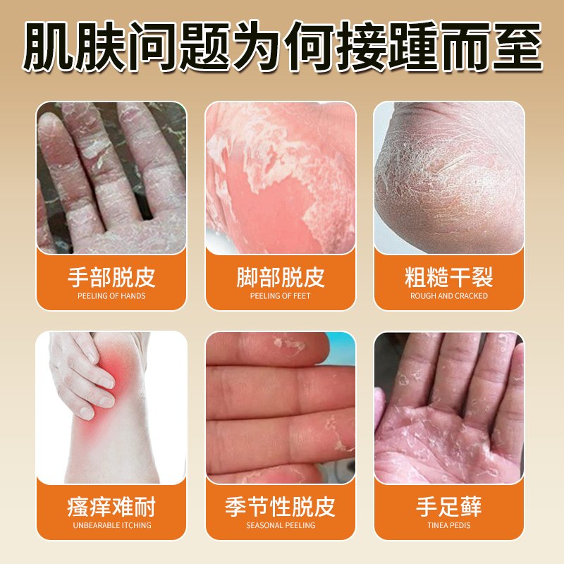 提眉手术是干嘛的？适合哪些人群？