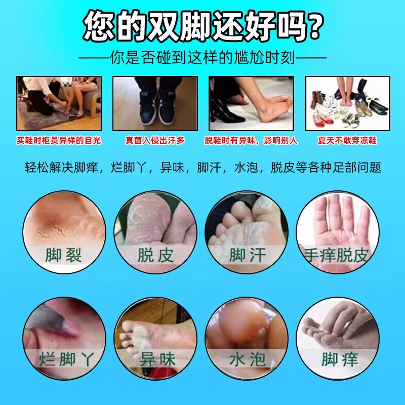 联苯苄唑乳膏：告别脚气困扰，重获清爽双脚！