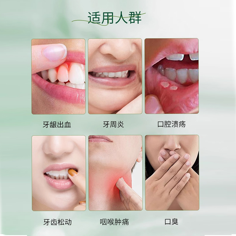 奇康西帕依固龈液：牙龈出血、口腔溃疡救星，30ml*2瓶装解决你的口腔烦恼！