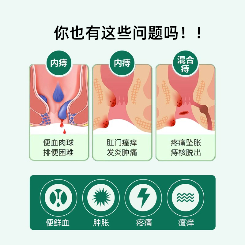 同仁堂痔疮凝胶真能用吗？医用敷料+内外兼治，这波科普太值了！