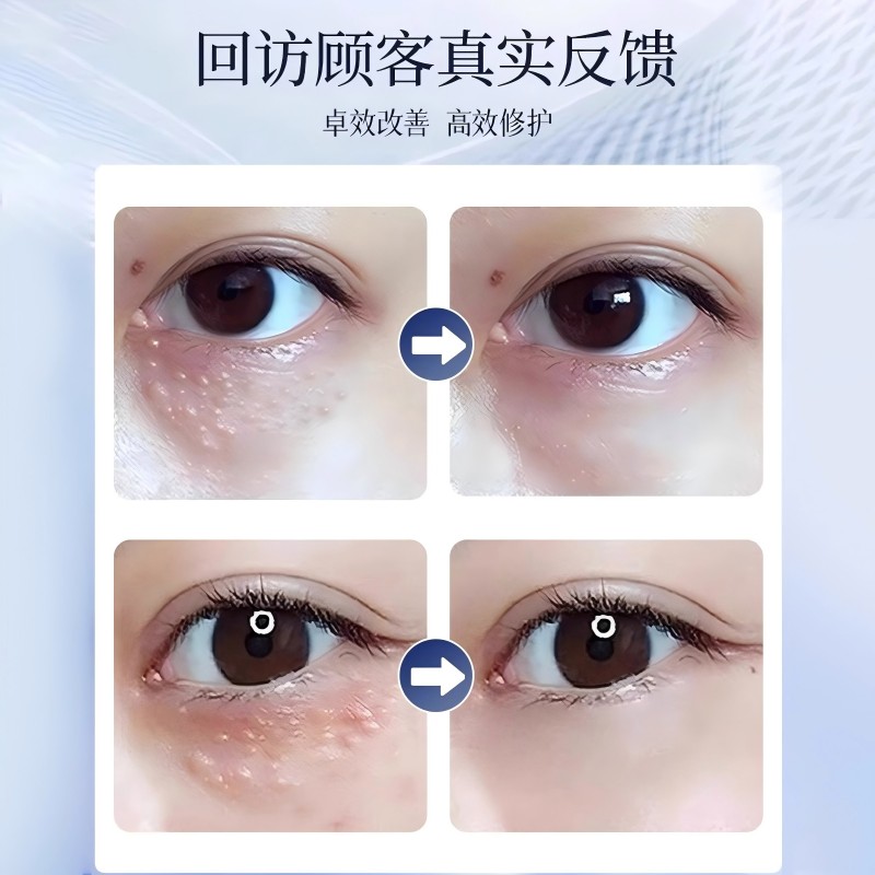 告别眼角痒痒，护眼神器大揭秘！✨
